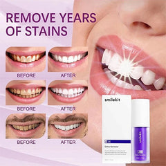 SmileKit Teeth Whitening Toothpaste