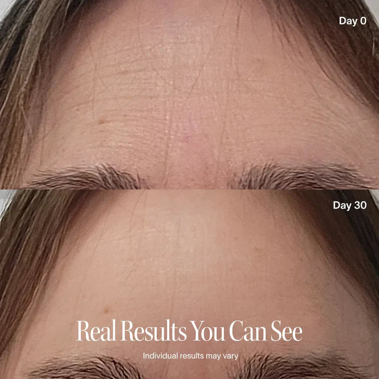 Solawave LED Face Mask