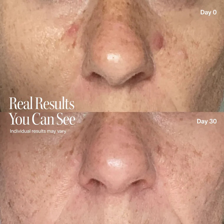 Solawave LED Face Mask